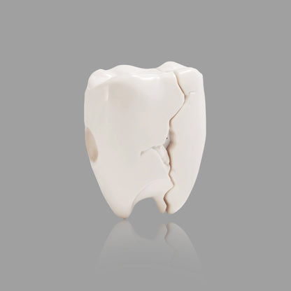 Cracked Tooth Shape AirPods Case
