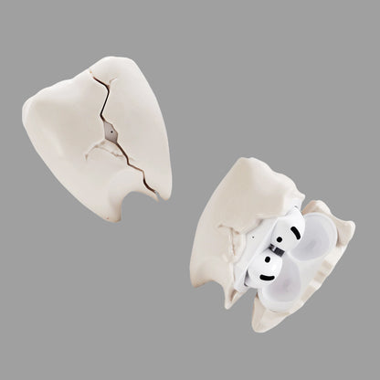 Cracked Tooth Shape AirPods Case